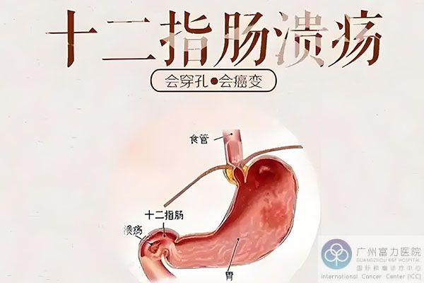 十二指肠癌.jpeg