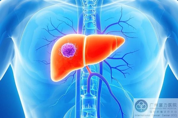 肝癌.jpg